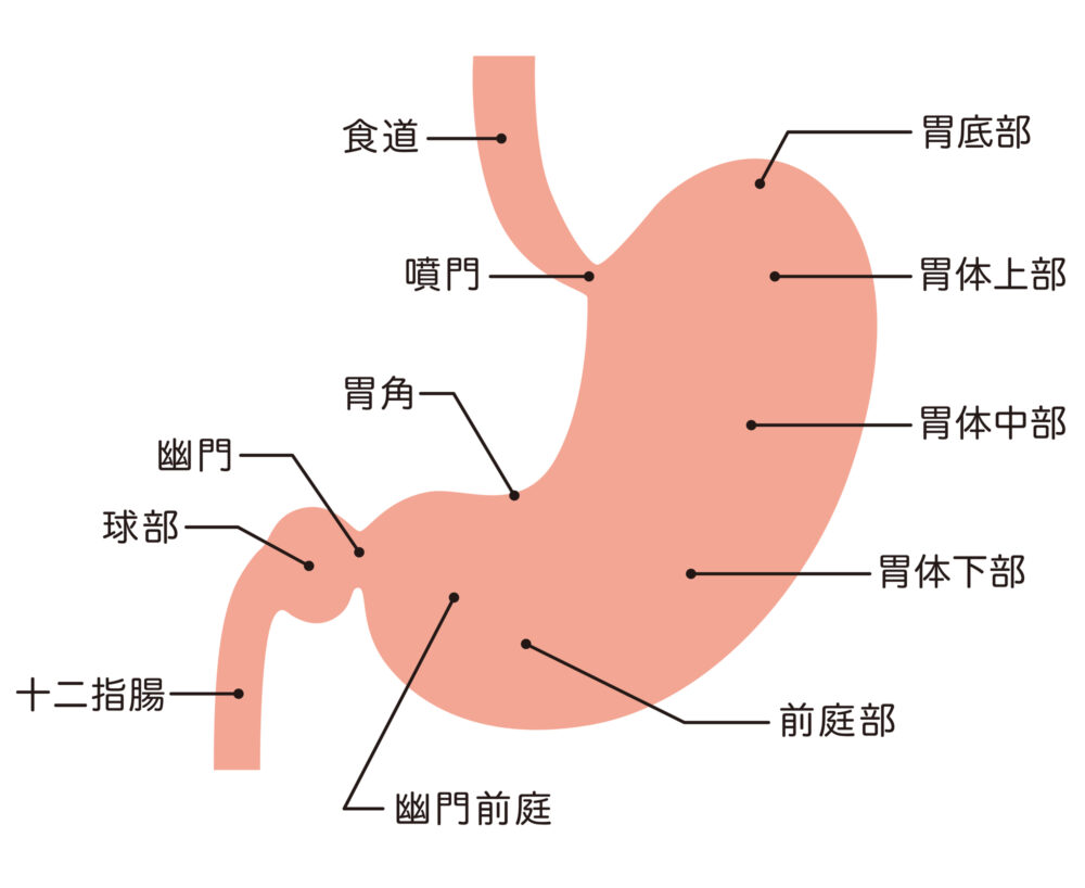 胃がんとは